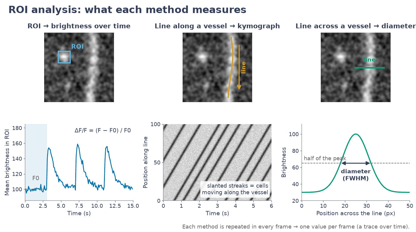 ROI brightness over time (ΔF/F), a kymograph along a vessel and the vessel diameter at half maximum across it.