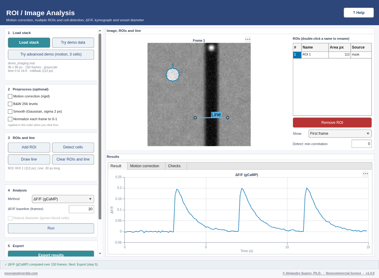 ROI / Image Analysis on the demo data.